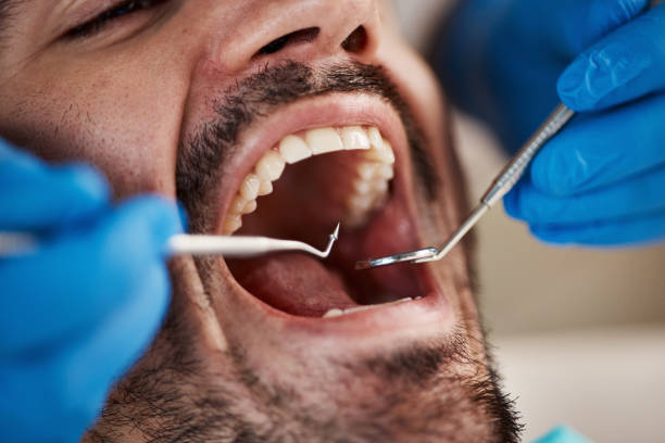 Best Urgent Care for Lost Fillings or Crowns in Benicia, CA